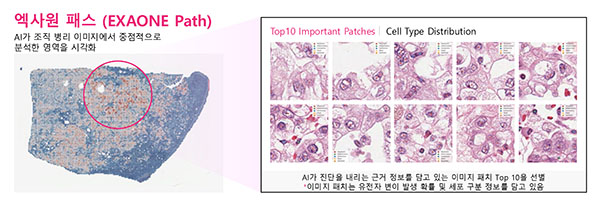 ▲엑사원 패스는 전체 슬라이드 이미지(WSI)에서 암과 관련된 유전자 변이를 예측할 수 있다./사진=LG